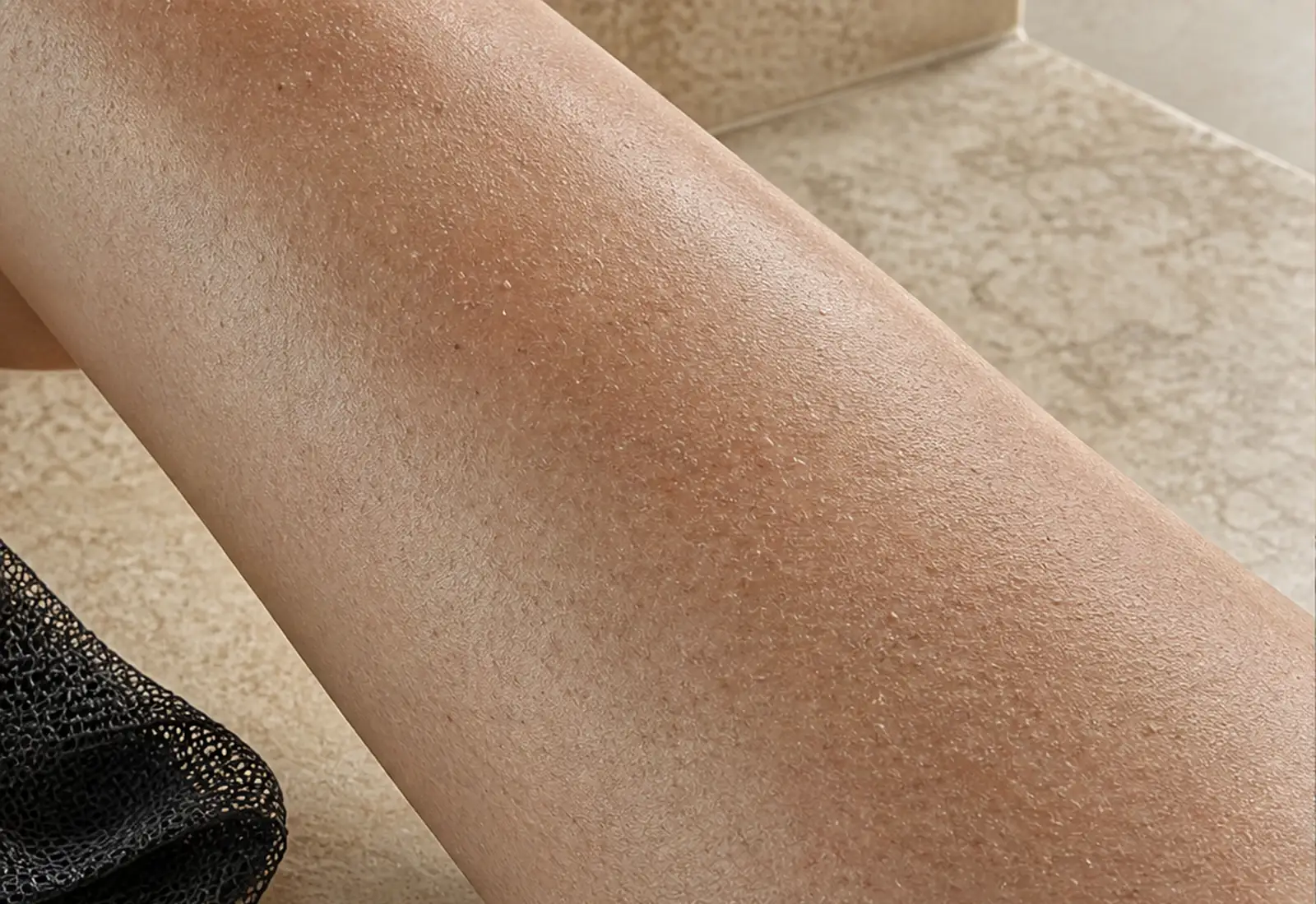 Peau avant exfoliation